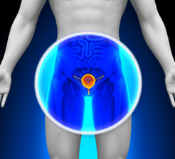 Prostate bladder highlighted