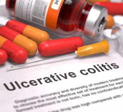 Ulcerative colitis concept