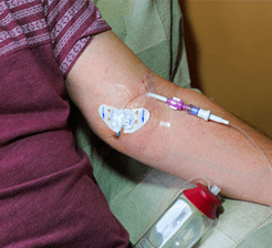 Chemotherapy
