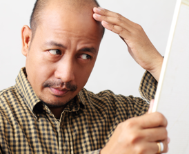 Avodart may help combat hair loss