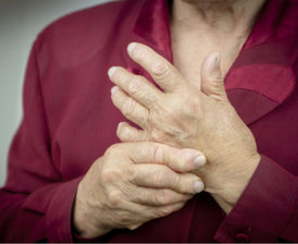 Older woman with rheumatoid arthritis